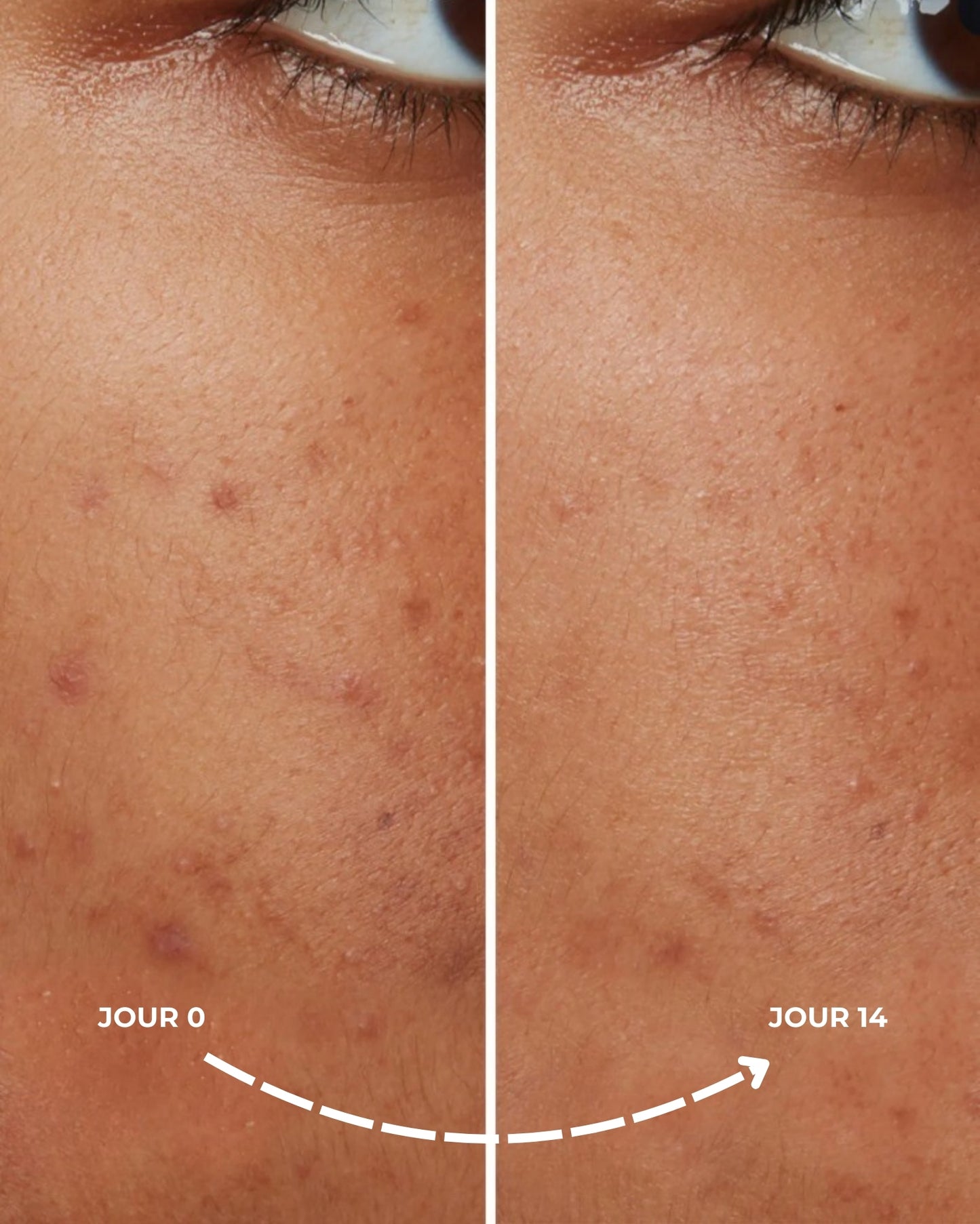 AYLIE Niacinamide 10 % – Sérum Apaisant & Anti‑Imperfections